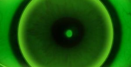 Fluobild Augenoptiker Kontaktlinsenspezialist Optometrie